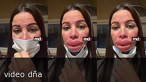 videa